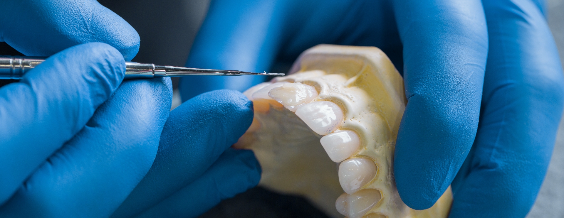 Dental Restoration